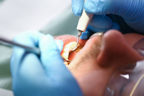 Best Emergency Treatment for Jaw Pain or Injury in Hutchinson Island South, FL