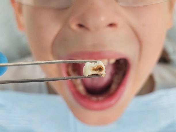 Best Walk-In Emergency Dental Services in Hutchinson Island South, FL